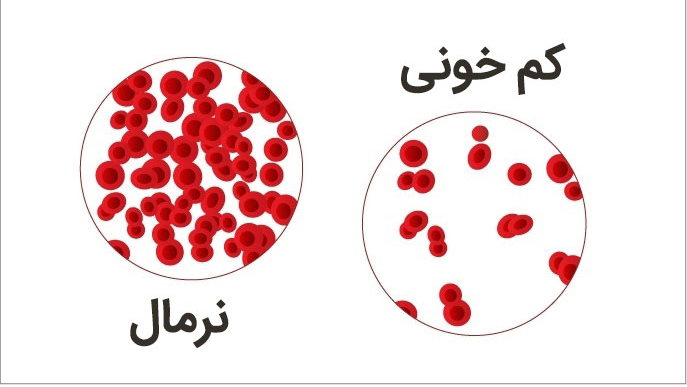 تاثیر قرص کلسیم در کاهش خطر ابتلا به کم خونی